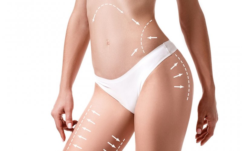 Kayseri Enza VIP ile Bölgesel İncelme: Fit ve Sıkı Bir Görünüm Mümkün